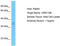 Leucine Rich Repeat Containing 10B antibody, TA337416, Origene, Western Blot image 