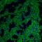 CD38 Molecule antibody, NBP2-25265AF647, Novus Biologicals, Immunocytochemistry image 