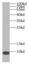 Dapit antibody, FNab09301, FineTest, Western Blot image 