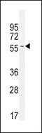 Inhibin Subunit Beta A antibody, MBS9201920, MyBioSource, Western Blot image 