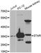 Steroidogenic Acute Regulatory Protein antibody, LS-C331212, Lifespan Biosciences, Western Blot image 