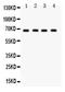 G Protein-Coupled Receptor Kinase 5 antibody, PB9708, Boster Biological Technology, Western Blot image 