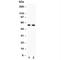 Alkaline Phosphatase, Biomineralization Associated antibody, R30170, NSJ Bioreagents, Western Blot image 