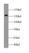 Gse1 Coiled-Coil Protein antibody, FNab04529, FineTest, Western Blot image 