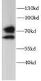 Glucuronidase Beta antibody, FNab10761, FineTest, Western Blot image 