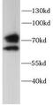 Gus antibody, FNab10761, FineTest, Western Blot image 