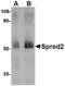 Sprouty Related EVH1 Domain Containing 2 antibody, A06368, Boster Biological Technology, Western Blot image 