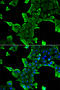 Neuronal Calcium Sensor 1 antibody, STJ28538, St John