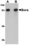BORA Aurora Kinase A Activator antibody, TA306757, Origene, Western Blot image 