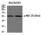 Myocyte Enhancer Factor 2D antibody, PA5-40202, Invitrogen Antibodies, Western Blot image 