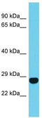 Family With Sequence Similarity 204 Member A antibody, TA330713, Origene, Western Blot image 