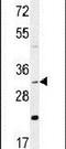 DnaJ Heat Shock Protein Family (Hsp40) Member B13 antibody, PA5-24368, Invitrogen Antibodies, Western Blot image 