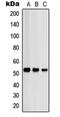 Protein Kinase CAMP-Dependent Type II Regulatory Subunit Beta antibody, orb214440, Biorbyt, Western Blot image 