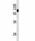 Dual Specificity Tyrosine Phosphorylation Regulated Kinase 1B antibody, F44009-0.4ML, NSJ Bioreagents, Western Blot image 