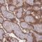 Sulfotransferase Family 2B Member 1 antibody, PA5-59696, Invitrogen Antibodies, Immunohistochemistry frozen image 