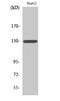 Colony Stimulating Factor 2 Receptor Beta Common Subunit antibody, A02219-1, Boster Biological Technology, Western Blot image 