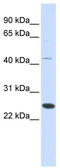 Protein-lysine methyltransferase METTL21A antibody, TA340405, Origene, Western Blot image 