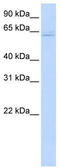 TNF Receptor Associated Factor 6 antibody, TA329137, Origene, Western Blot image 