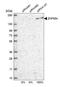 Zinc Finger Protein 654 antibody, HPA036173, Atlas Antibodies, Western Blot image 