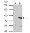 Serine/threonine-protein kinase PAK 6 antibody, NBP2-19685, Novus Biologicals, Immunoprecipitation image 