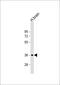 Nicotinamide Nucleotide Adenylyltransferase 1 antibody, 61-158, ProSci, Western Blot image 