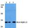 Major Histocompatibility Complex, Class II, DQ Beta 1 antibody, A00106-2, Boster Biological Technology, Western Blot image 