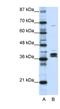 Heterogeneous Nuclear Ribonucleoprotein D Like antibody, NBP1-57156, Novus Biologicals, Western Blot image 