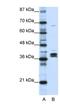 Heterogeneous Nuclear Ribonucleoprotein D Like antibody, NBP1-57156, Novus Biologicals, Western Blot image 