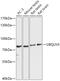Ubiquilin 3 antibody, 18-051, ProSci, Western Blot image 