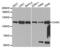 Calcium/Calmodulin Dependent Serine Protein Kinase antibody, abx001945, Abbexa, Western Blot image 