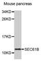 Protein transport protein Sec61 subunit beta antibody, MBS129617, MyBioSource, Western Blot image 