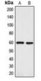 Dopachrome Tautomerase antibody, GTX56299, GeneTex, Western Blot image 