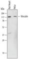 Vinculin antibody, AF6896, R&D Systems, Western Blot image 