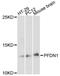 Prefoldin Subunit 1 antibody, A8681, ABclonal Technology, Western Blot image 