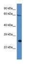 Inositol 1,4,5-Trisphosphate Receptor Interacting Protein antibody, NBP1-79876, Novus Biologicals, Western Blot image 