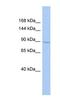 SH3 Domain Containing Ring Finger 1 antibody, NBP1-54972, Novus Biologicals, Western Blot image 