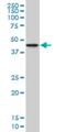 NDRG Family Member 2 antibody, H00057447-M06, Novus Biologicals, Western Blot image 