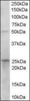 15-Hydroxyprostaglandin Dehydrogenase antibody, orb88985, Biorbyt, Western Blot image 