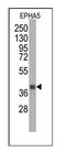 EPH Receptor A5 antibody, AM11061PU-N, Origene, Western Blot image 