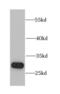 Charged Multivesicular Body Protein 1B antibody, FNab01657, FineTest, Western Blot image 