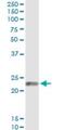 Endothelin 1 antibody, H00001906-M01, Novus Biologicals, Immunoprecipitation image 