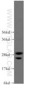 Inhibitor Of Growth Family Member 4 antibody, 10617-1-AP, Proteintech Group, Western Blot image 