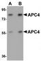 Anaphase Promoting Complex Subunit 4 antibody, TA319904, Origene, Western Blot image 