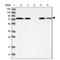 Alpha Fetoprotein antibody, NBP2-80483, Novus Biologicals, Western Blot image 