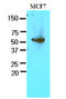 Glucose-6-Phosphate Dehydrogenase antibody, AM09088PU-S, Origene, Western Blot image 