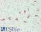 Macrophage Scavenger Receptor 1 antibody, LS-B14544, Lifespan Biosciences, Immunohistochemistry paraffin image 