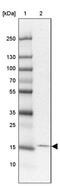 Transmembrane protein 100 antibody, PA5-63213, Invitrogen Antibodies, Western Blot image 