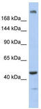 Centrosomal Protein 170B antibody, TA334090, Origene, Western Blot image 