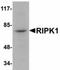 Receptor Interacting Serine/Threonine Kinase 1 antibody, orb89840, Biorbyt, Western Blot image 
