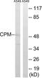 Carboxypeptidase M antibody, abx014320, Abbexa, Western Blot image 